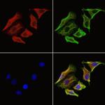 SKAP2 Antibody in Immunocytochemistry (ICC/IF)