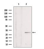 SULT4A1 Antibody in Western Blot (WB)