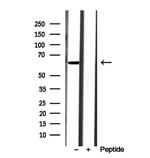 AdoHcyase 2 Antibody in Western Blot (WB)