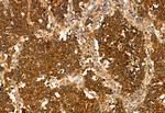 HMGCS1 Antibody in Immunohistochemistry (Paraffin) (IHC (P))