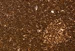 SPOP Antibody in Immunohistochemistry (Paraffin) (IHC (P))