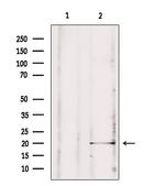 MPV17 Antibody in Western Blot (WB)