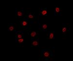 MTA3 Antibody in Immunocytochemistry (ICC/IF)