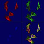 MYH7 Antibody in Immunocytochemistry (ICC/IF)