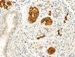 MYH7 Antibody in Immunohistochemistry (Paraffin) (IHC (P))