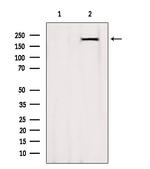 MYH7 Antibody in Western Blot (WB)