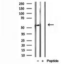 NEU4 Antibody in Western Blot (WB)