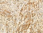 PSAT1 Antibody in Immunohistochemistry (Paraffin) (IHC (P))