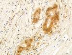 PSAT1 Antibody in Immunohistochemistry (Paraffin) (IHC (P))