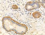 PSAT1 Antibody in Immunohistochemistry (Paraffin) (IHC (P))