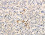 PSAT1 Antibody in Immunohistochemistry (Paraffin) (IHC (P))