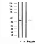 PSAT1 Antibody in Western Blot (WB)