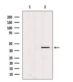 PSAT1 Antibody in Western Blot (WB)