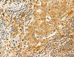 PYGL Antibody in Immunohistochemistry (Paraffin) (IHC (P))