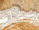 PYGL Antibody in Immunohistochemistry (Paraffin) (IHC (P))