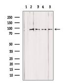 PYGL Antibody in Western Blot (WB)