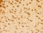 TELO2 Antibody in Immunohistochemistry (Paraffin) (IHC (P))