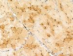 TELO2 Antibody in Immunohistochemistry (Paraffin) (IHC (P))