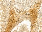 TELO2 Antibody in Immunohistochemistry (Paraffin) (IHC (P))