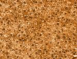 TELO2 Antibody in Immunohistochemistry (Paraffin) (IHC (P))