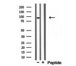 TELO2 Antibody in Western Blot (WB)