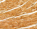 UGT2B7 Antibody in Immunohistochemistry (Paraffin) (IHC (P))