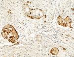 UGT2B7 Antibody in Immunohistochemistry (Paraffin) (IHC (P))