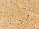 UGT2B7 Antibody in Immunohistochemistry (Paraffin) (IHC (P))