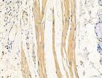 UGT2B7 Antibody in Immunohistochemistry (Paraffin) (IHC (P))