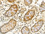 ACSL4 Antibody in Immunohistochemistry (Paraffin) (IHC (P))