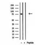 ACSL4 Antibody in Western Blot (WB)