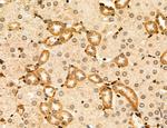 CAPZA1 Antibody in Immunohistochemistry (Paraffin) (IHC (P))