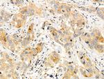 CAPZA1 Antibody in Immunohistochemistry (Paraffin) (IHC (P))