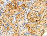 CAPZA1 Antibody in Immunohistochemistry (Paraffin) (IHC (P))