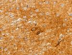 Clathrin Light Chain Antibody in Immunohistochemistry (Paraffin) (IHC (P))