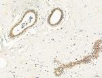 Clathrin Light Chain Antibody in Immunohistochemistry (Paraffin) (IHC (P))