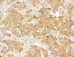 Clathrin Light Chain Antibody in Immunohistochemistry (Paraffin) (IHC (P))