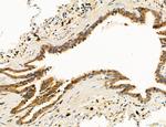 Clathrin Light Chain Antibody in Immunohistochemistry (Paraffin) (IHC (P))