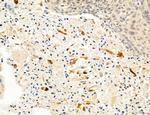 Clathrin Light Chain Antibody in Immunohistochemistry (Paraffin) (IHC (P))