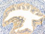 Clathrin Light Chain Antibody in Immunohistochemistry (Paraffin) (IHC (P))