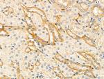 Clathrin Light Chain Antibody in Immunohistochemistry (Paraffin) (IHC (P))