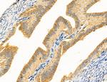 Clathrin Light Chain Antibody in Immunohistochemistry (Paraffin) (IHC (P))