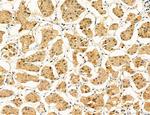 Clathrin Light Chain Antibody in Immunohistochemistry (Paraffin) (IHC (P))