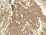 Clathrin Light Chain Antibody in Immunohistochemistry (Paraffin) (IHC (P))