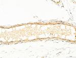 Clathrin Light Chain Antibody in Immunohistochemistry (Paraffin) (IHC (P))