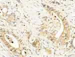 Clathrin Light Chain Antibody in Immunohistochemistry (Paraffin) (IHC (P))