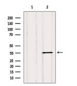 Clathrin Light Chain Antibody in Western Blot (WB)