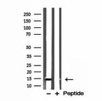 ISCU Antibody in Western Blot (WB)