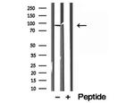 LMOD1 Antibody in Western Blot (WB)