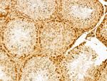 NUDT21 Antibody in Immunohistochemistry (Paraffin) (IHC (P))